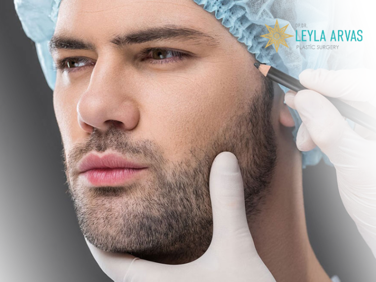 Beard And Mustache Transplantation Surgery Istanbul Turkey