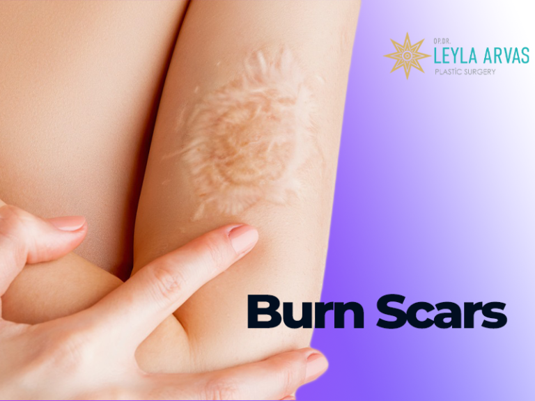 Burn Scars Expert Advice And Treatment Options 2024